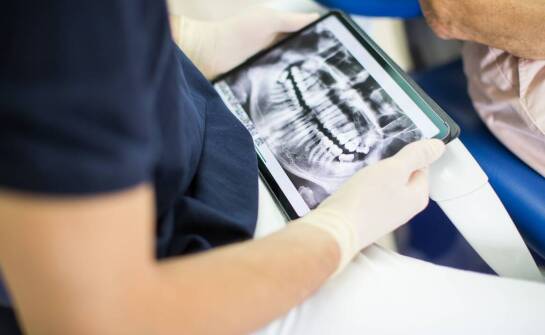 Jakie są korzyści z wykorzystania rentgena w leczeniu endodontycznym?