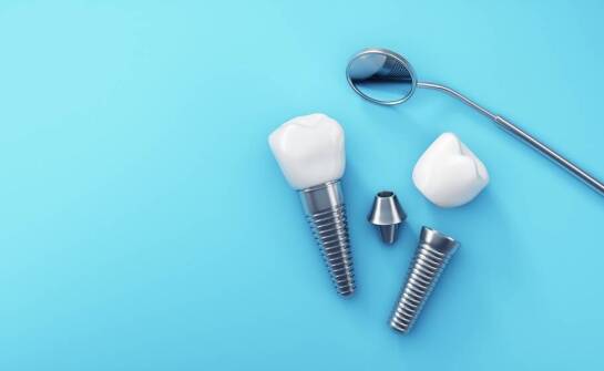 Jakie są najczęstsze pytania pacjentów dotyczące implantów? Odpowiada Dentysta Bochnia