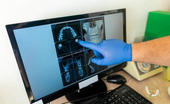 Rola rentgena w planowaniu zabiegów implantologicznych