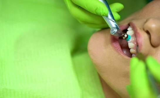 Jak tooth mousse wspiera pacjentów z aparatem ortodontycznym?