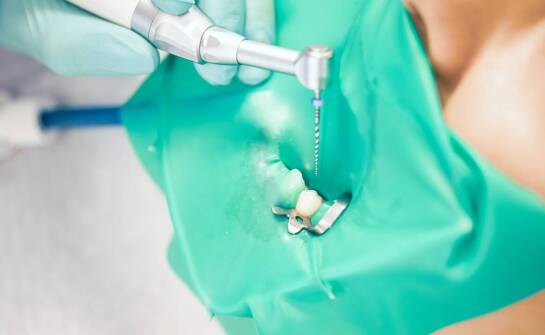 Kompozyt chemoutwardzalny: jak zapewnia szybkie i skuteczne wypełnienia?