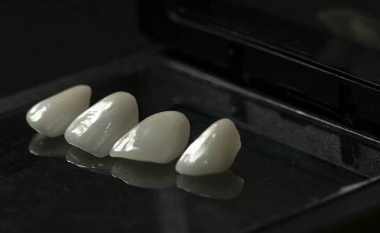 Zakładanie licówek - co warto wiedzieć o tej procedurze?