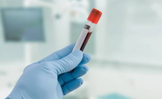 Krew w moczu. Dlaczego warto zgłosić ten fakt urologowi?