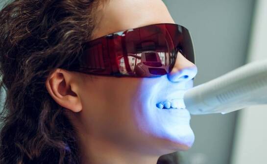Jakie są zalety stosowania nowoczesnych lamp LED w wybielaniu zębów?