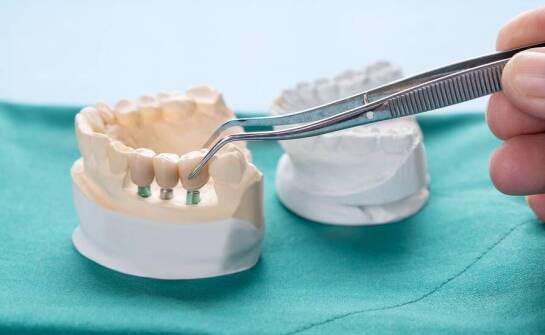 Nowoczesne materiały w protetyce: Co oferuje obecny rynek?