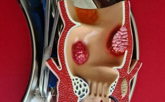 Znaczenie ureterorenoskopu w diagnostyce chorób dróg moczowych