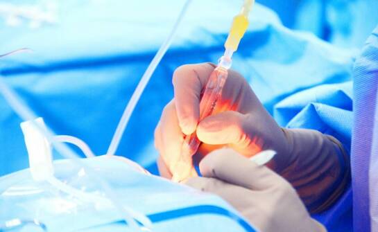 Czego można się spodziewać po zabiegu laserowej korekcji wzroku?