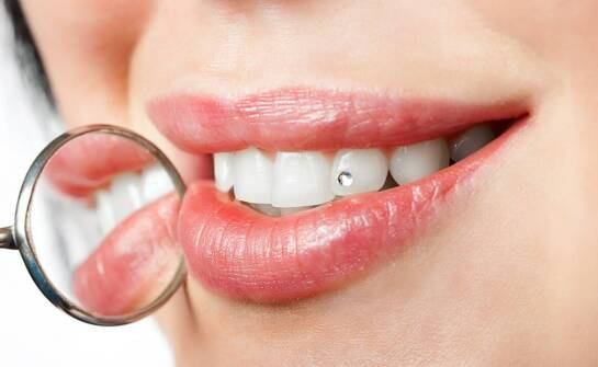 Biżuteria na zęby a profesjonalne życie – jak wpłynie na Twój wizerunek?