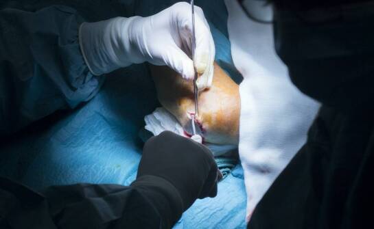 Jakie są najnowsze osiągnięcia w rekonstrukcji więzadła ACL?