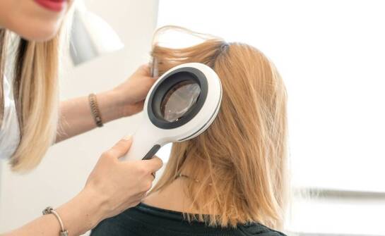 Łojotok a zdrowie włosów – jakie terapie oferuje trychologia?
