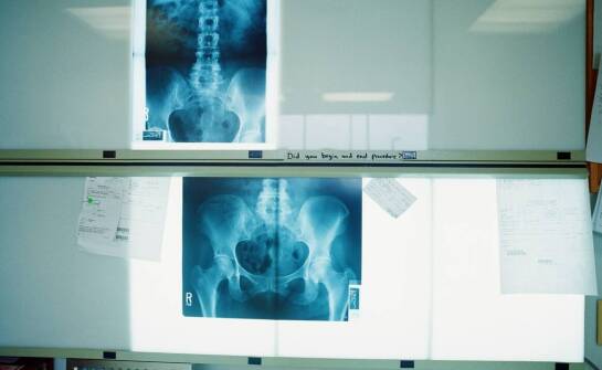 Wpływ zaawansowanych funkcji programów do zdjęć RTG na precyzję diagnostyki