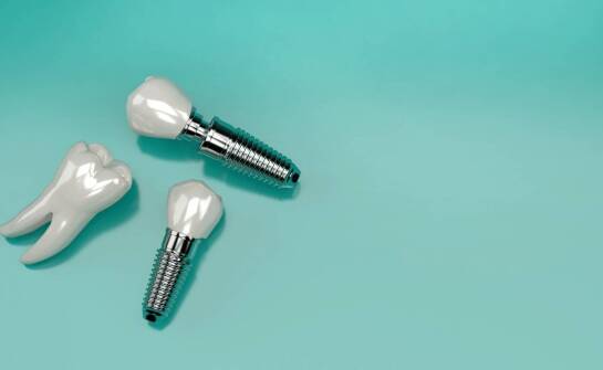 Co wyróżnia implanty stomatologiczne pod względem estetyki i funkcjonalności?