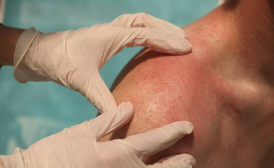 Co zostawia żądło: jak rozpoznać, że owad je pozostawił?