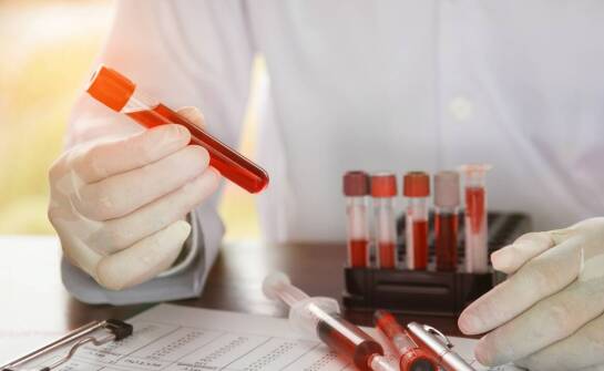 Czy można pić alkohol przed badaniami profilaktycznymi krwi?