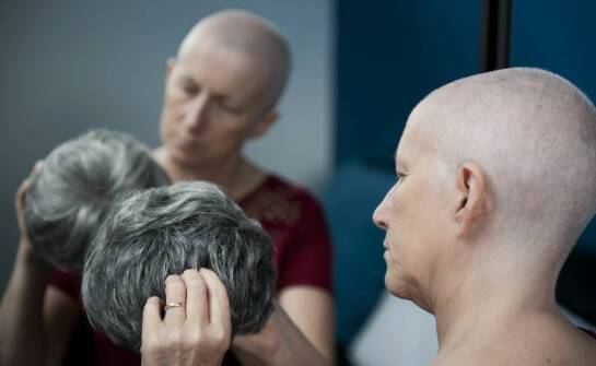 Kiedy warto skonsultować się z trychologiem na różnych etapach łysienia?