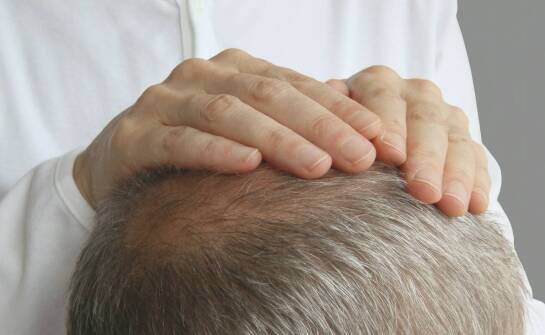 Wpływ grzybicy skóry głowy na kondycję włosów – jaką rolę odgrywa trycholog?