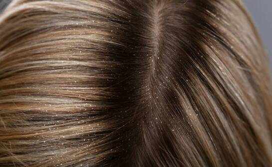 Trychologiczne podejście do problemów z wypadaniem włosów