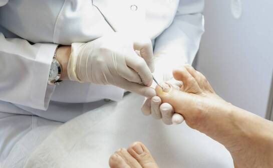 Proces korekty wrastających paznokci przy użyciu ortonoksyjnych klamer