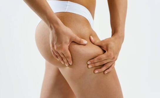 Jakie zabiegi na cellulit warto wykonać?