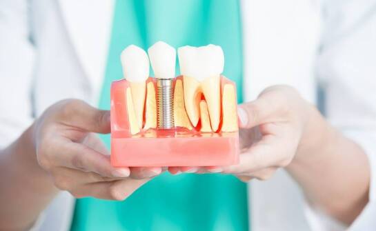 Wpływ diety na sukces implantacji zębów