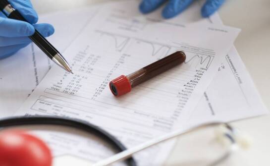 Jakie hematologiczne badania są kluczowe w diagnostyce interny?