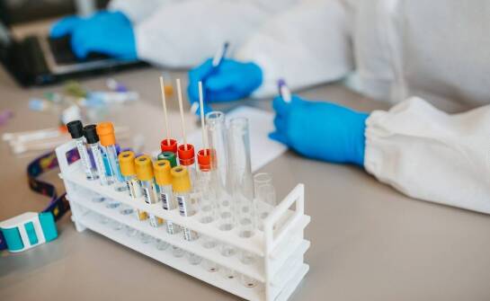 Jakie testy na SARS-CoV-2 oferuje diagnostyka w Żorach?