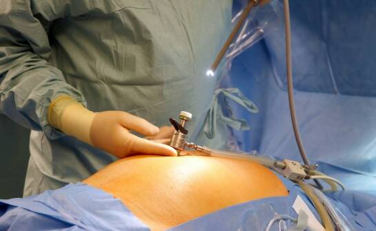 Wpływ gastroskopów na wczesne wykrywanie chorób układu pokarmowego