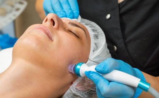 Czy mezoterapia mikroigłowa może być sposobem na rozstępy?