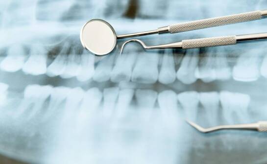 Jakie są wskazania do wykonania RTG zębów?