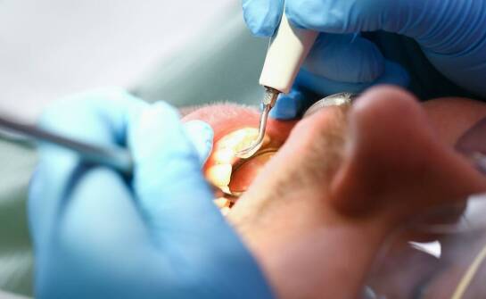 Innowacyjne właściwości płynnego koferdamu i ich wpływ na praktykę dentystyczną