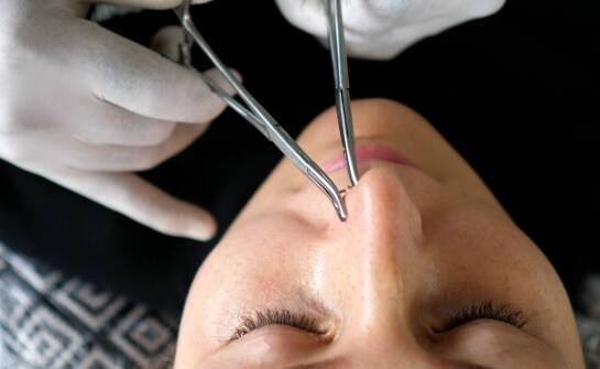 Jak wygląda proces gojenia po zabiegu korekcji nosa?