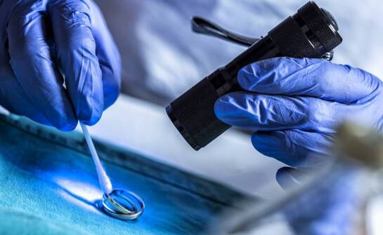 Dlaczego precyzyjne wypełnienie kanałów zębowych jest kluczowe dla zdrowia jamy ustnej?