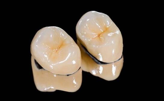 Jak wybrać odpowiedni rodzaj korony na implanty do swoich potrzeb?