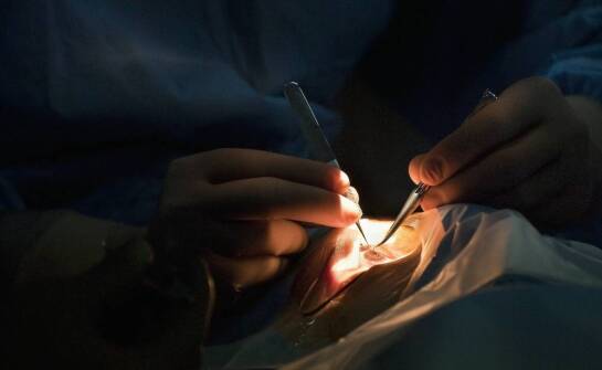 Jakie koszty pokrywa refundacja protezy oka, a co pacjent musi opłacić samodzielnie?