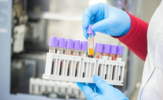 Jak diagnostyczne testy przyczyniają się do szybkiego wykrywania zakażeń CMV?