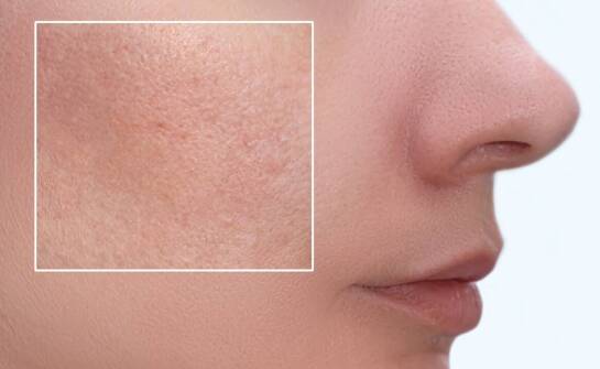 Jakie są możliwe powikłania po zabiegach usuwania blizn?