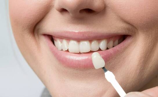 Korekta kształtu zębów przy użyciu porcelanowych licówek – co oferuje stomatolog?