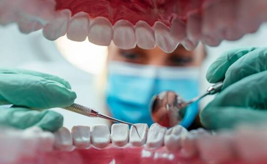 Jakie są zalety stosowania implantów zębów przy odbudowie uśmiechu?