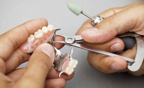 Jak wygląda proces dopasowywania zębowych protez do pacjenta?