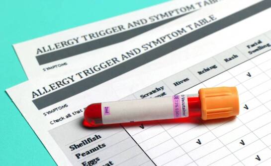 Testy alergiczne z wykorzystaniem biorezonansu: innowacyjne metody i korzyści