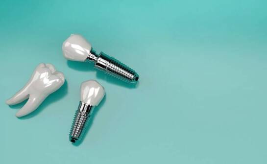 Diagnostyka przedimplantacyjna: klucz do sukcesu w implantologii