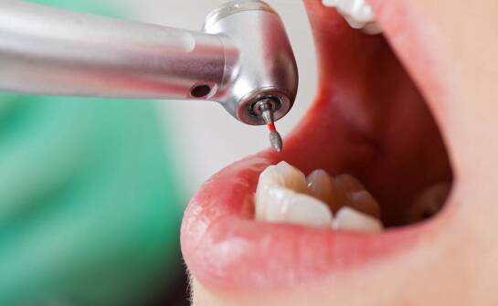 Jak wygląda leczenie próchnicy?