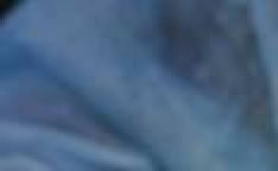 Tenodeza kolana: na czym polega ten zabieg i kto powinien go rozważyć?