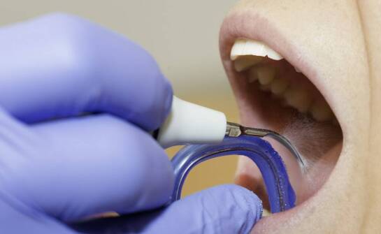 Kiedy fleczer uratuje ząb przed infekcją?