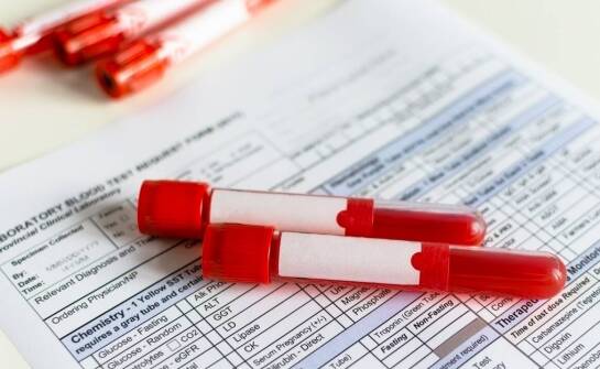 Jak długo przed badaniem diagnostycznym nie należy palić papierosów?