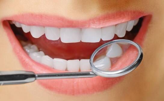 Jak wybielanie zębów może poprawić estetykę uśmiechu?