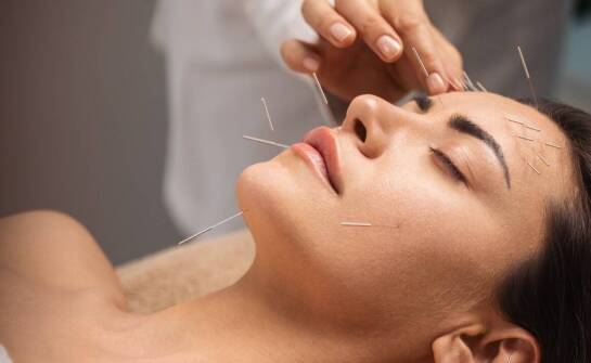 Akupunktura jako element terapii bólu głowy typu napięciowego