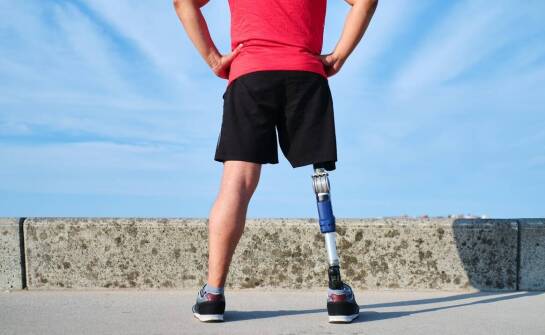 Rola nowoczesnych nóg protez w rehabilitacji i odzyskiwaniu mobilności