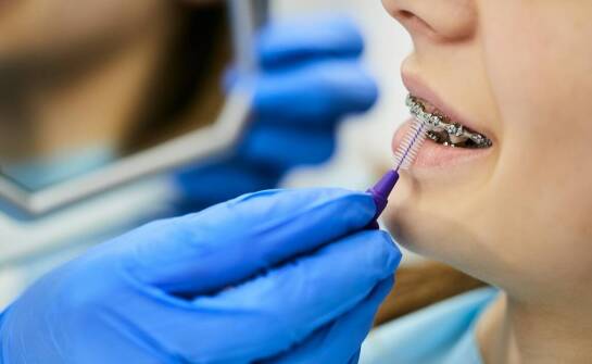 Jakie zdrowotne korzyści płyną z korekty zgryzu?