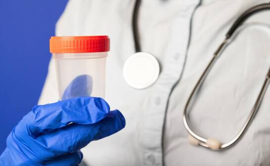 Aus welchen Werkstoffen werden Urinbecher hergestellt?